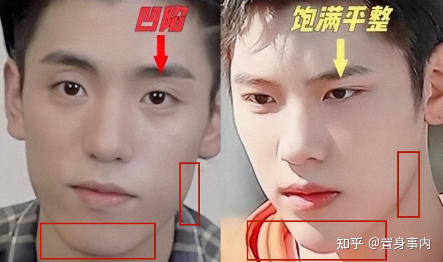 出道后跑去“动脸”，“换了头”还称纯天然，这些明星不羞吗？ - 知乎