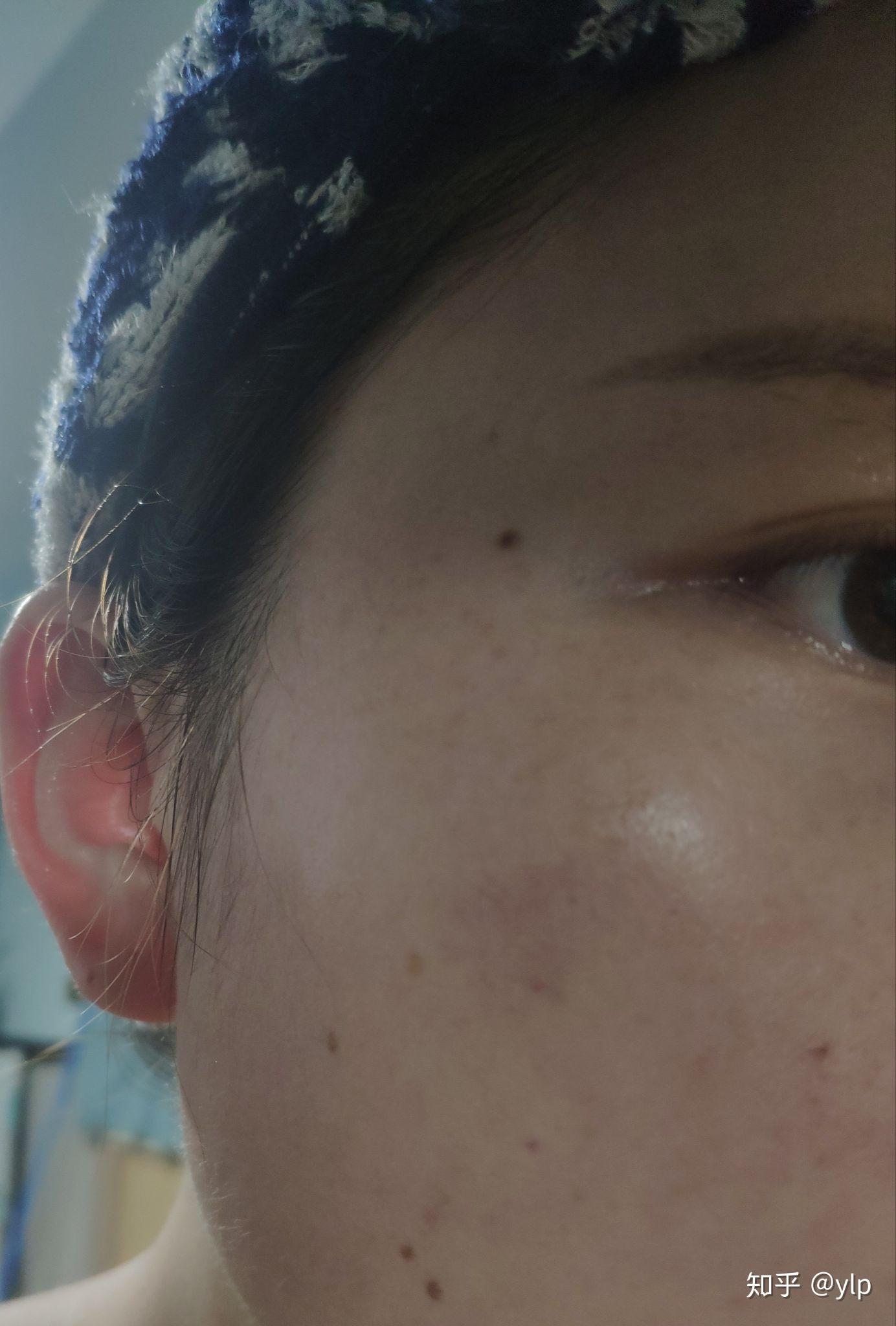 期待三周后的效果呢珂蒂丝的产品不含人造香精,酒精,色素,敏感肌及