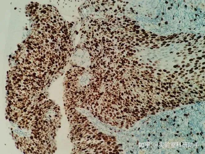 一文搞定免疫组化结果分析，超实用 - 知乎