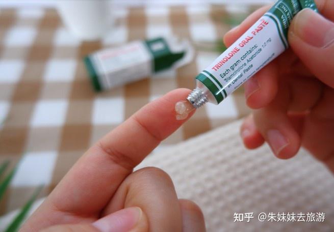 膏采用的原料是一种能快速治疗或减轻口疡的曲安奈德(triamcinolone