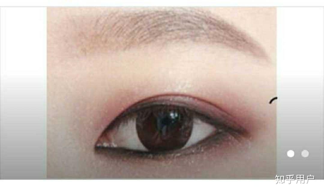 内双和外双的区别是什么?因为有人告诉我,双眼皮的褶皱和眼角有交点就是内双,无论你的双眼皮多宽? - 知乎