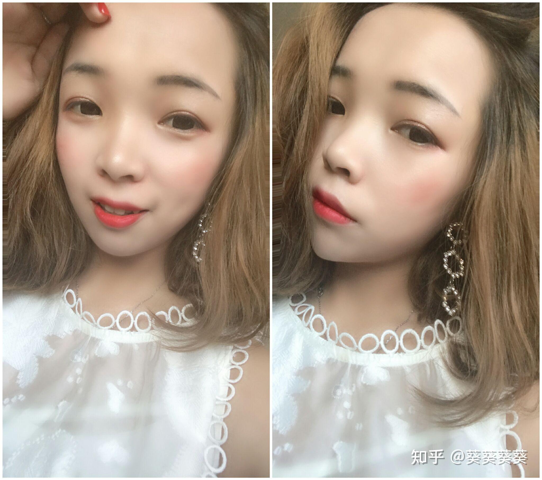 美人三分龅颜值不够还是得整牙