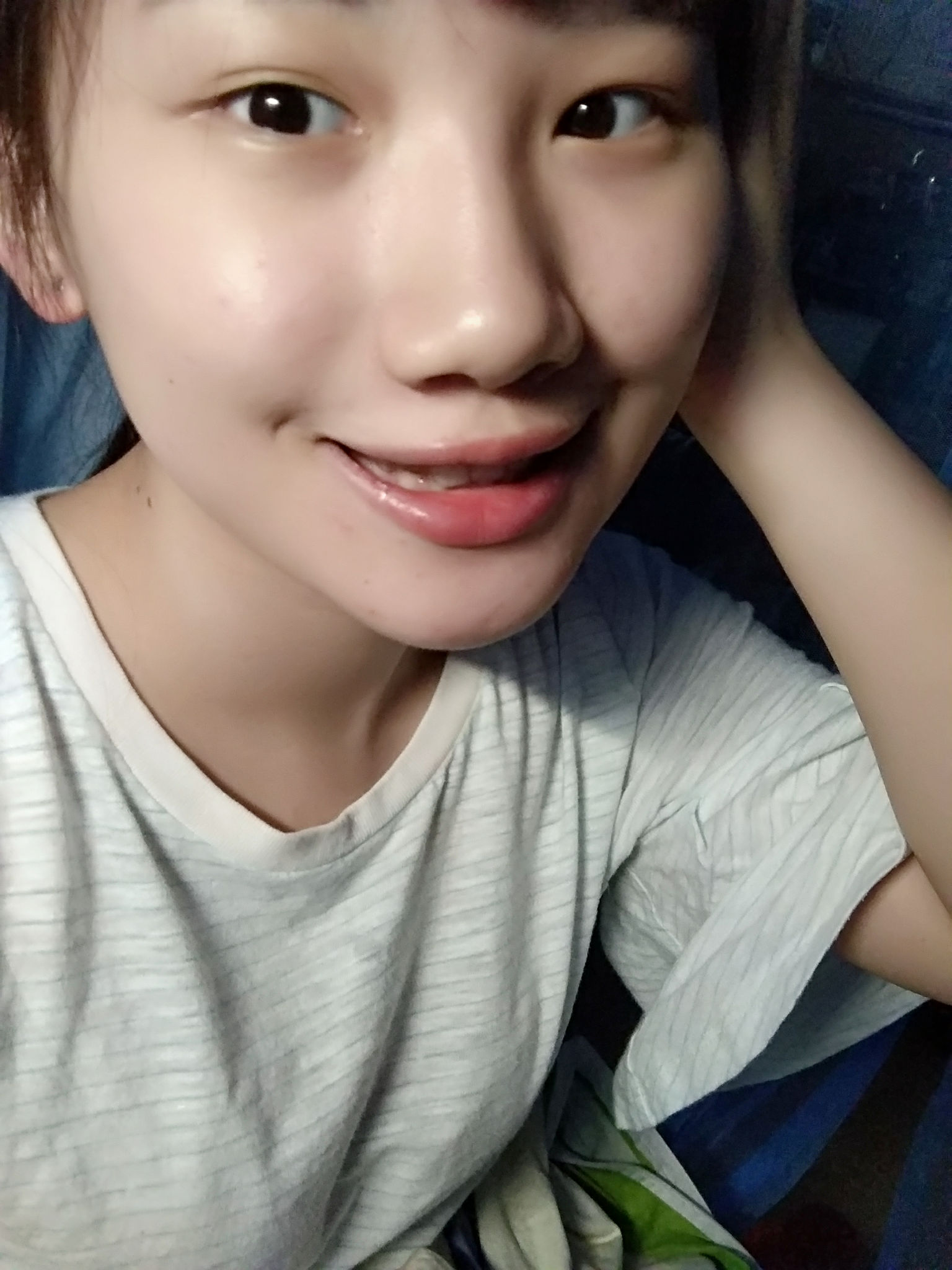 嘴角上面的窝是什么啊酒窝梨涡皱纹