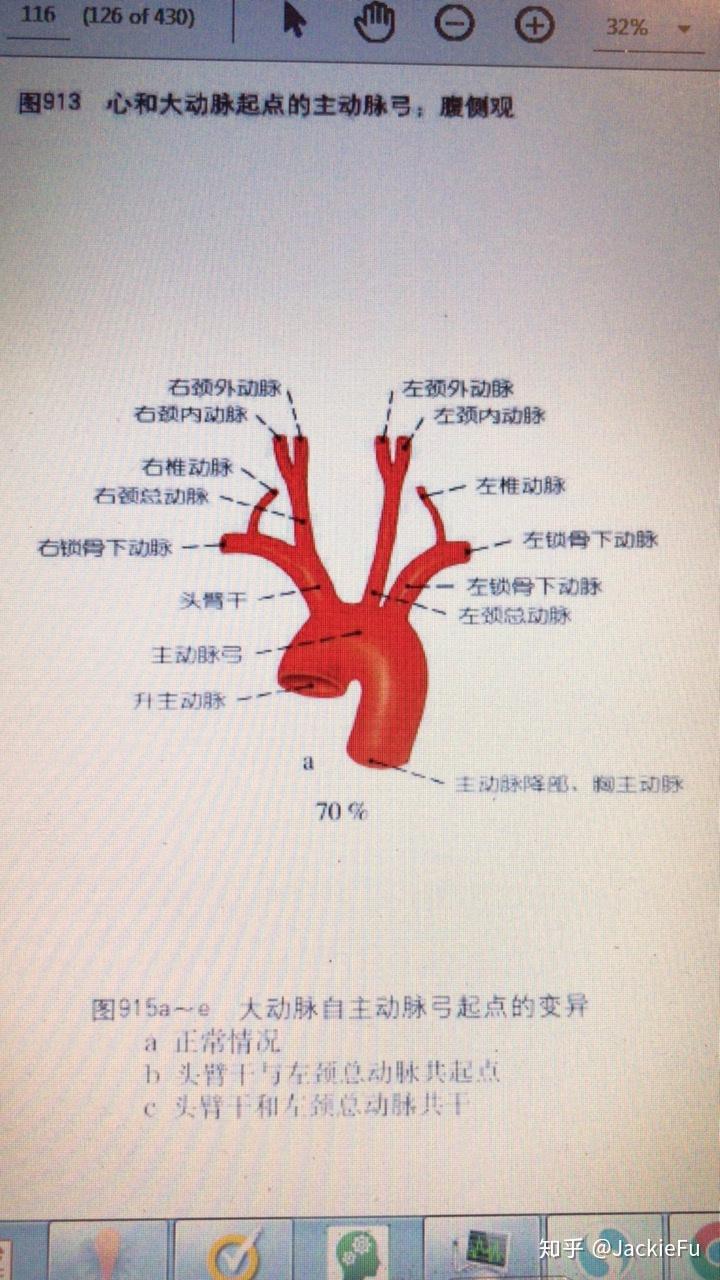 胸主动脉解剖 