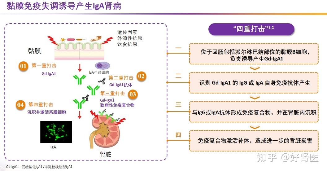 就可以知道为什么耐赋康03nefecon布地奈德肠溶胶囊能成为全球首个
