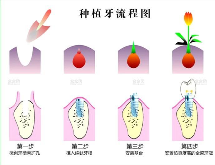 种植步骤图片ppt图片