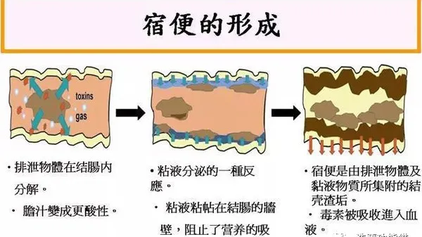 如今春节假期已经结束是时候让肠胃好好地休养一下辟谷清理油腻的肠胃