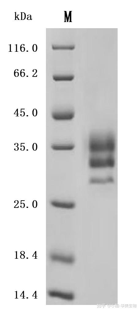 Ltbr Structure 淋巴毒素β受体(LTBR)研究全景:结构、功能、疾病关联与药物研发新进展 - 知乎