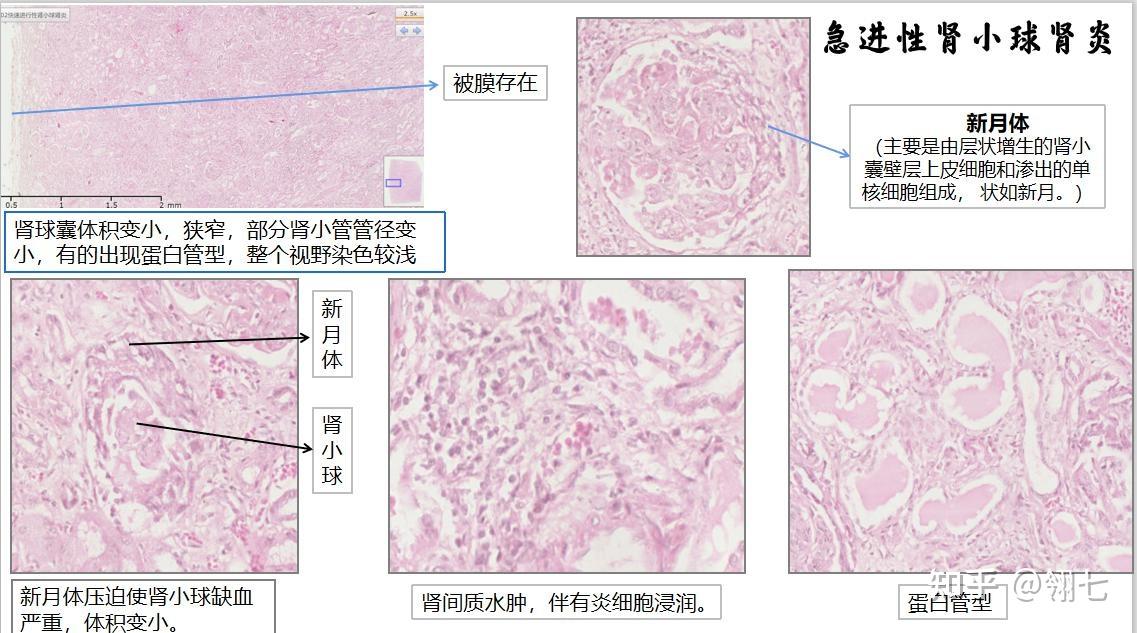 肾组织切片显微镜讲解图片