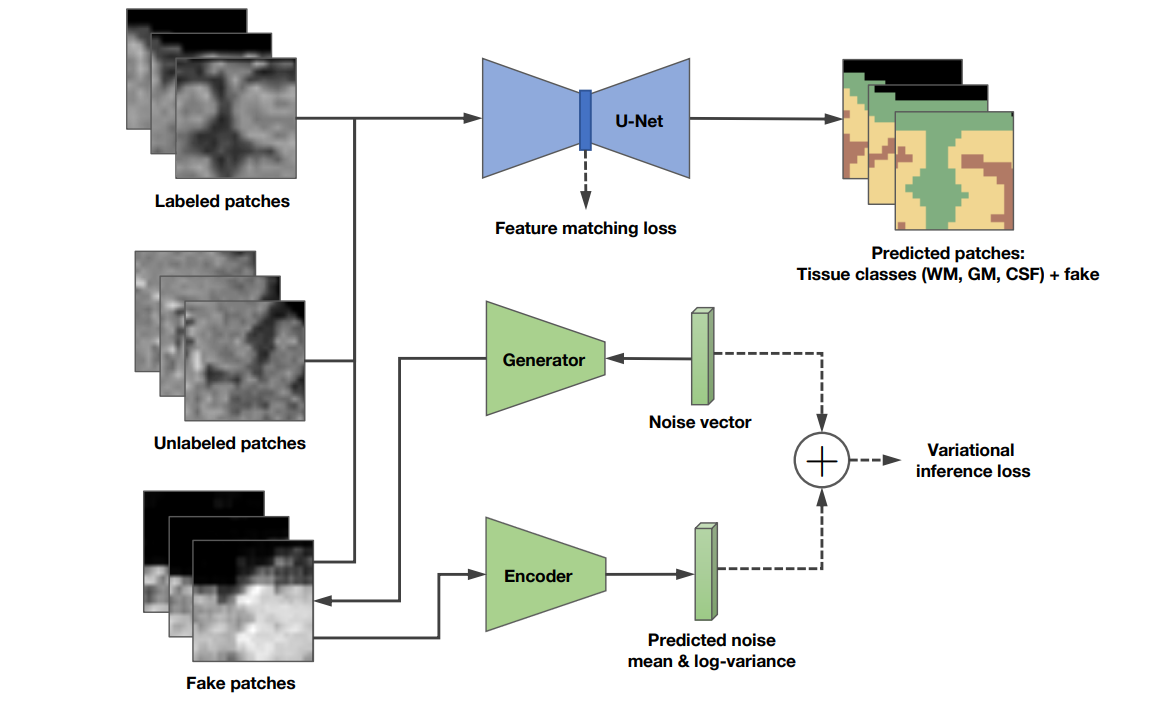 【medical image segmentation】a dataset of laryngeal endoscopic