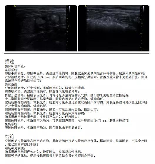 肠道反应性淋巴结肿大腹部彩超显示无异物,但是症状还是没有改善