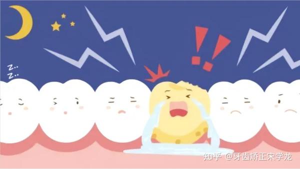 夜间磨牙的原因及防治措施!—义乌口腔护理 - 知乎