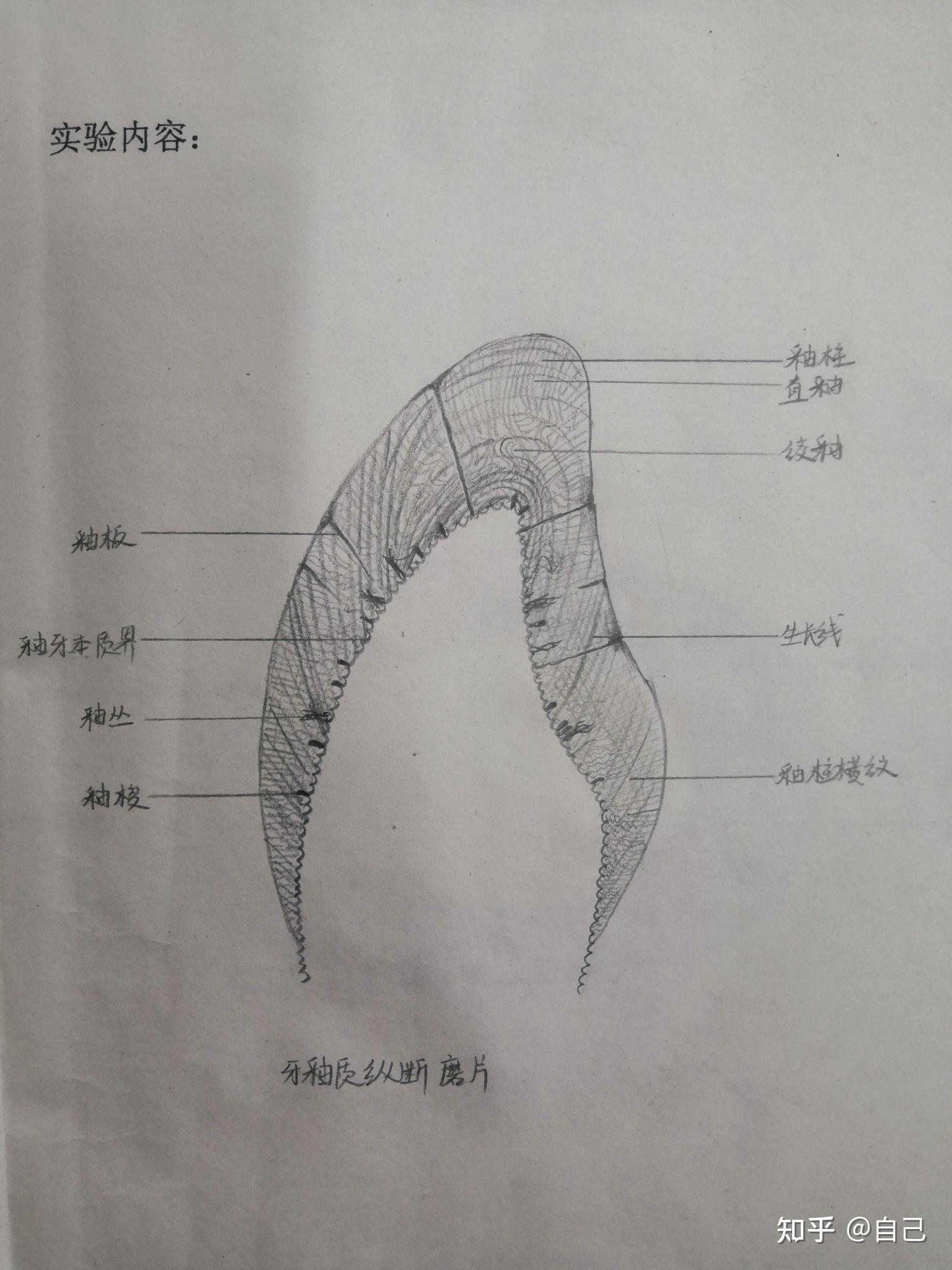 牙垢螺旋体手绘图片图片