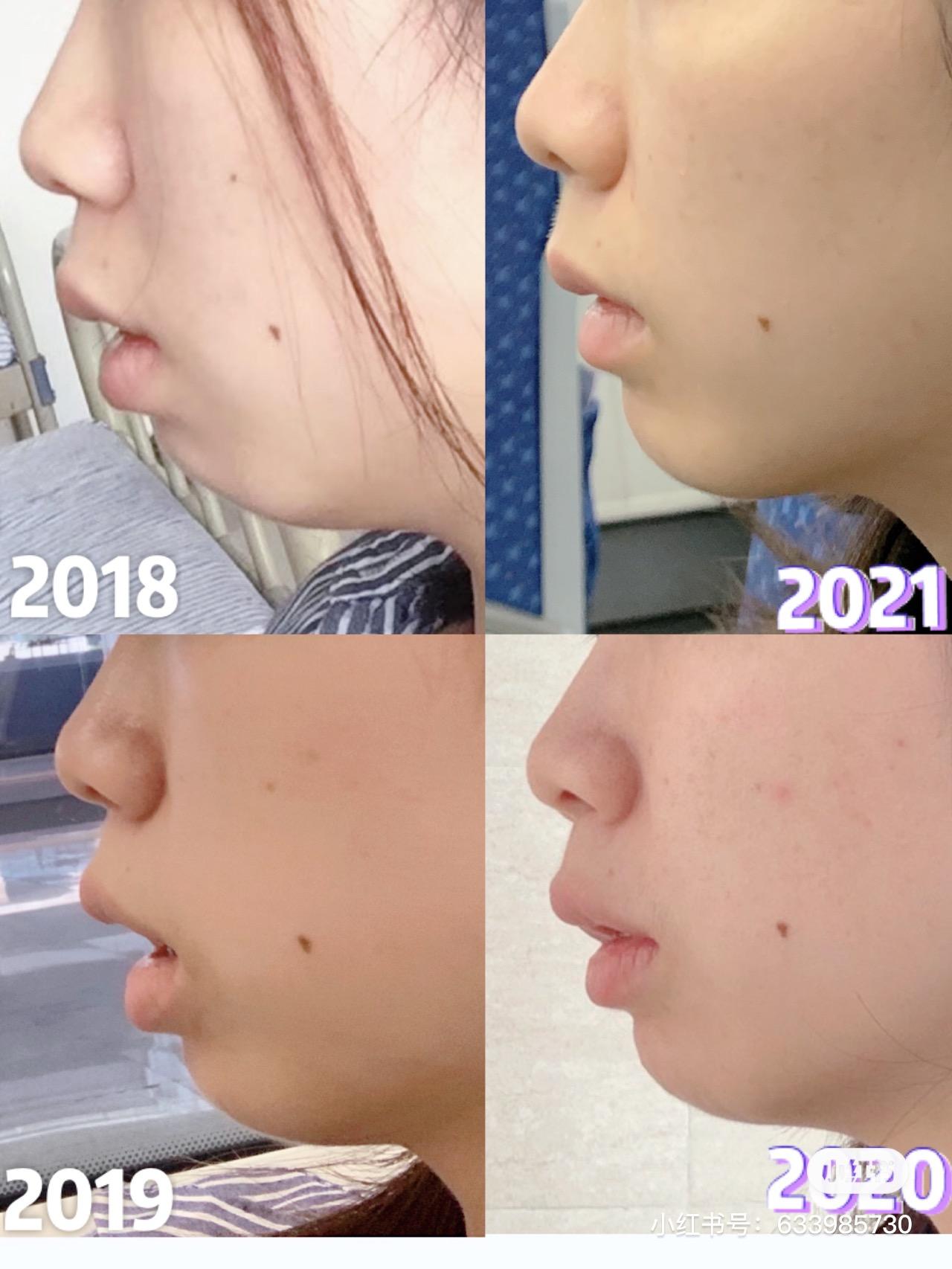 v2-109b49edaafebded075990e1078a5456_1440w.jpg?source=172ae18b