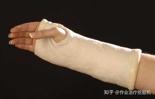 由于可以在较短的四个星期内就实现骨折的愈合,因此建议采用石膏固定