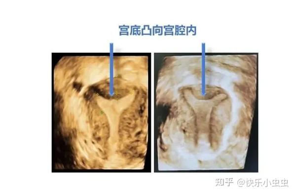 三维世界里的子宫 - 知乎
