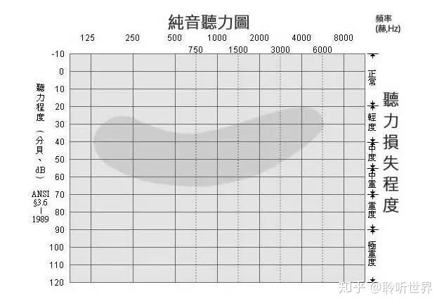 聽力科普61什麼是聽閾