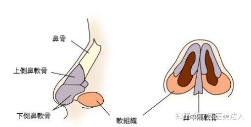 隆鼻时为什么不建议使用鼻中隔软骨做鼻尖和鼻小柱