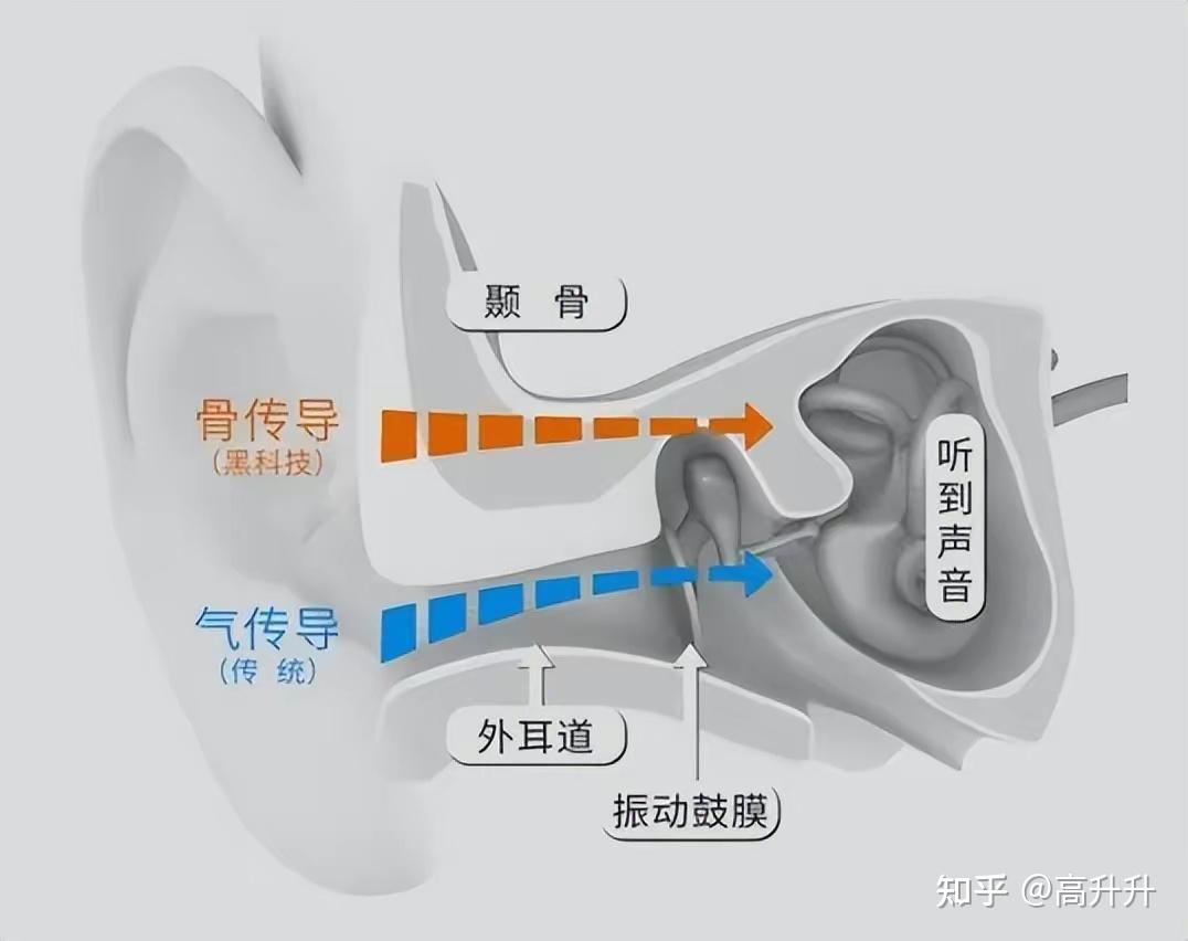 骨传导耳机结构图图片