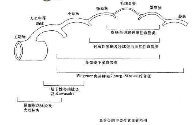 腹痛與風溼病 - 知乎