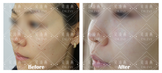 v2-117f70abb043d8d7e1bb446ce91baa0b_r.jpg