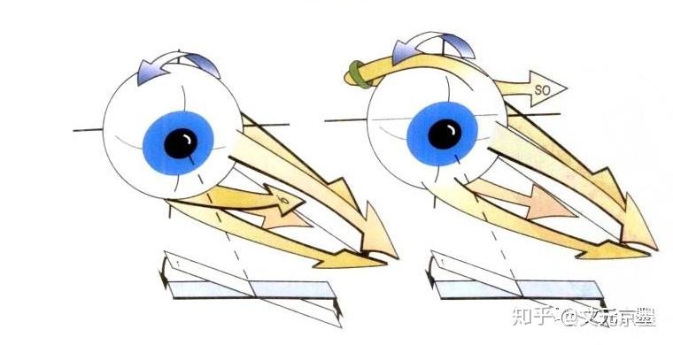 向左下看时眼外肌运动这好像和前面分析的不对呀.