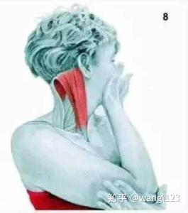 长期用电脑伏案工作,肩颈痛,如何治疗和保养?