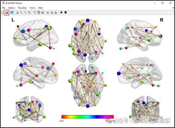第2期 BrainNet viewer脑图绘制 - 知乎