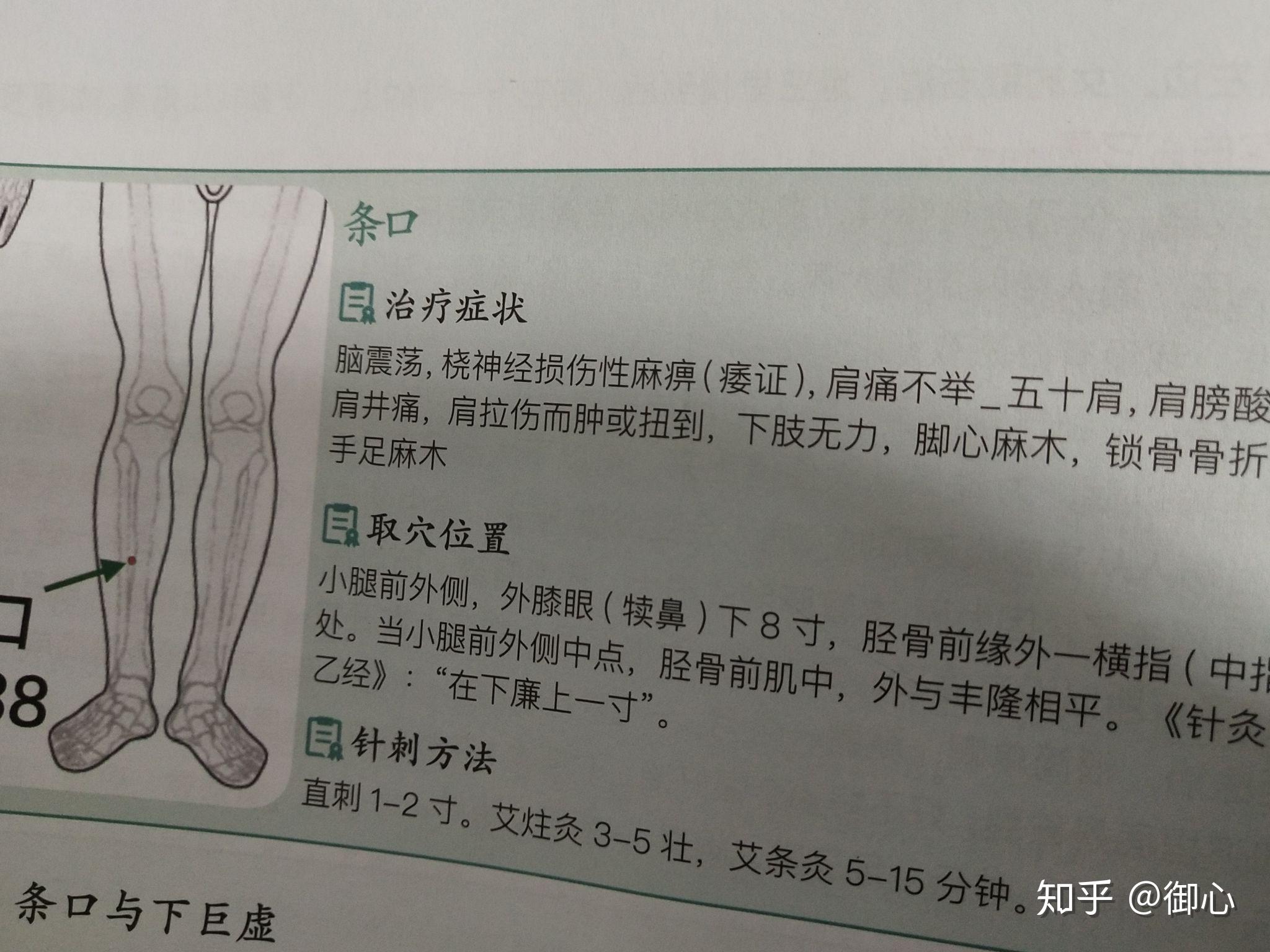 艾灸条口穴肩关节周围炎属"痹症"范畴,属"十二经