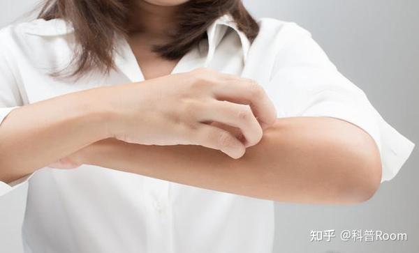 人为什么会感觉痒?“痒”感从何而来? - 知乎