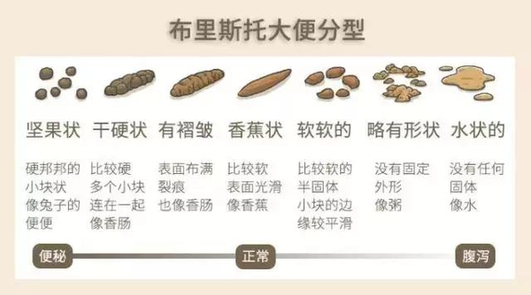 健康的大便颜色、形状长什么样？有这10种情况要注意 - 知乎