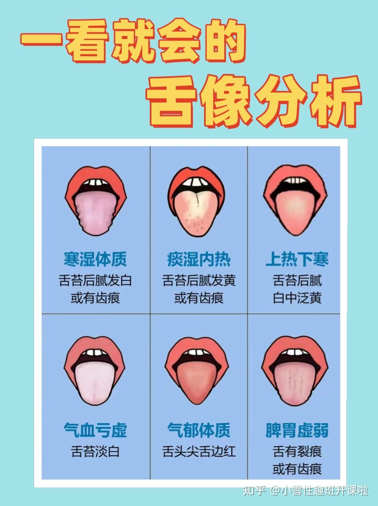 一看就会的舌像分析 - 知乎