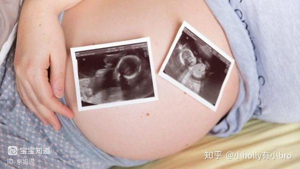 怀孕38周胎死腹中 孕期胎儿三种 求救 信号 孕妈要及时接收 知乎