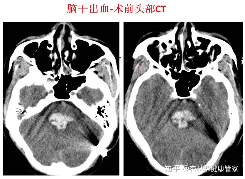 北京中医医院健康管家CT加急-北京中医医院健康管家ct加急要多久 北京中医医院健康管家CT加急-北京中医医院健康管家ct加急要多久