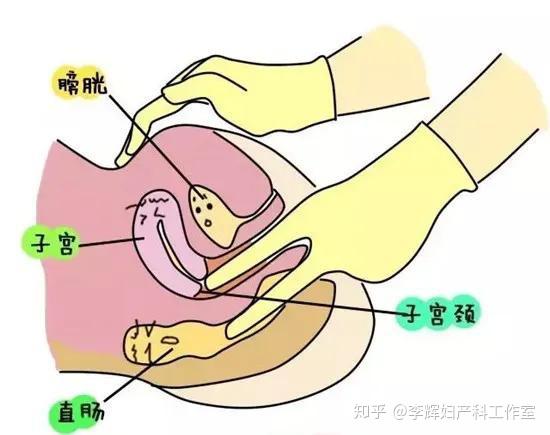 妇科检查了解一下