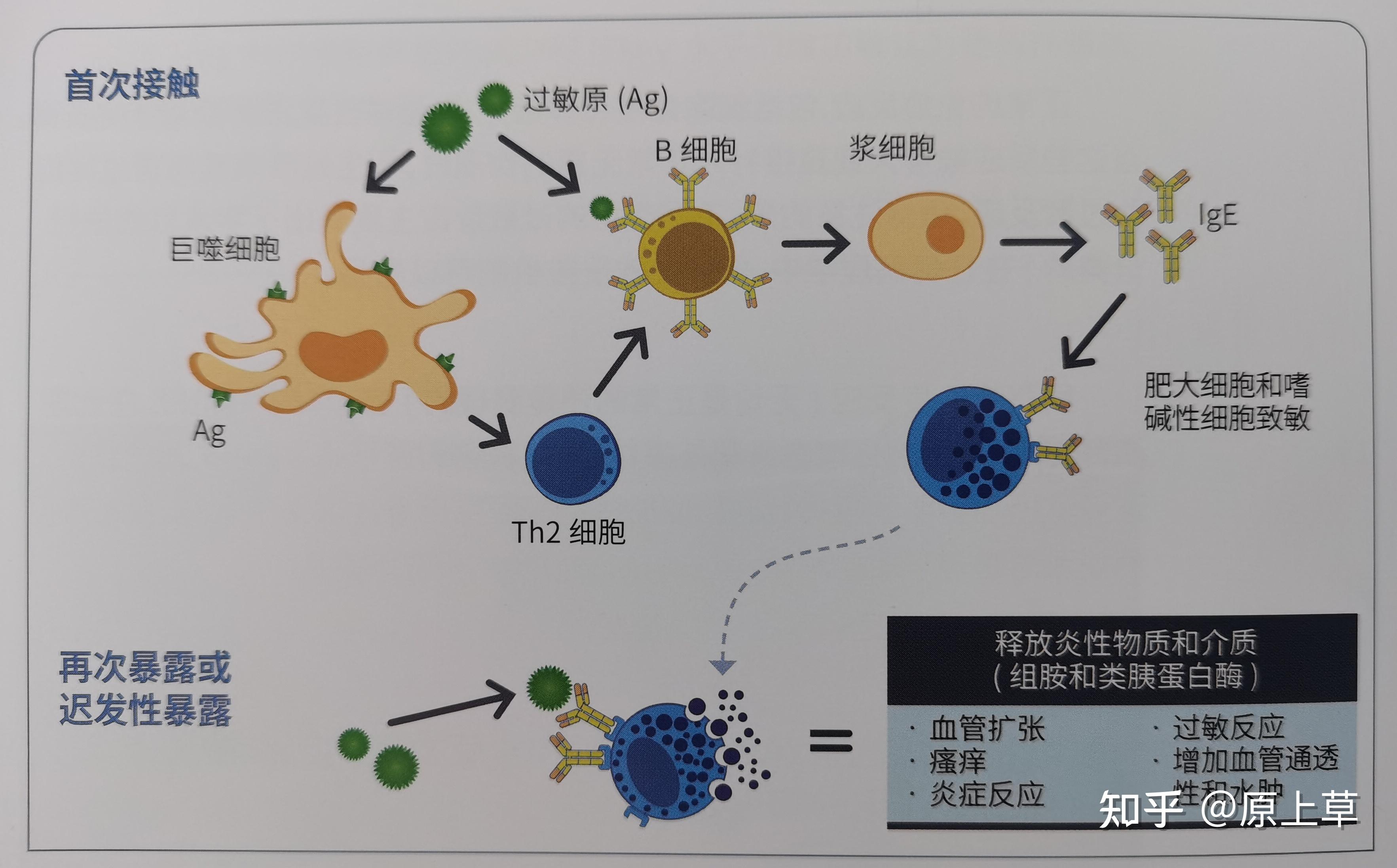 這種反應引起的損傷是由於th2淋巴細胞和免疫球蛋白e(ige)介導