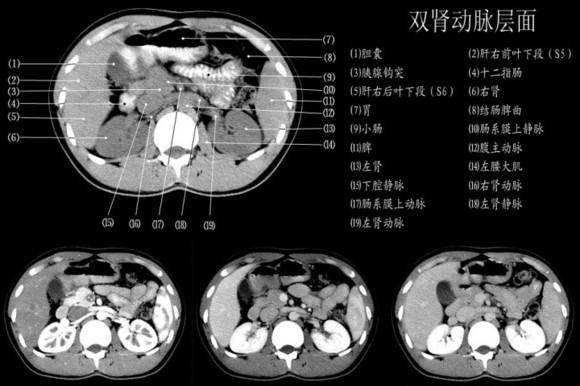 一图教你读懂 腹部CT - 知乎
