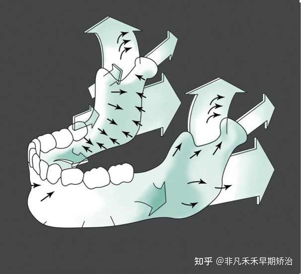 『早期矫治』早矫医生应该知道的事儿:出生后颅面部的生长发育——前颅底与颌骨的生长 - 知乎
