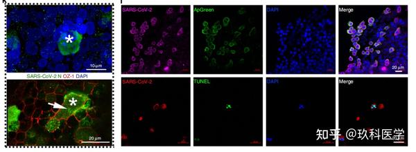 技巧分享 | 免疫荧光实验原来还有那么多细节 - 知乎