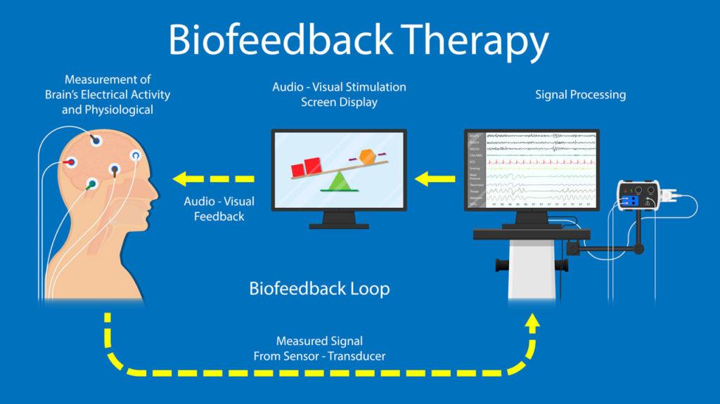 脑机启侦|每周一篇轻百科：神经反馈（Neurofeedback）——如同健身一样训练你的大脑（08.17） - 知乎