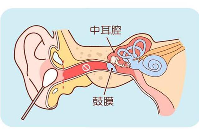 鼓膜會缺少中間的纖維組織層,一般不能再受衝擊,很容易會導致再次穿孔