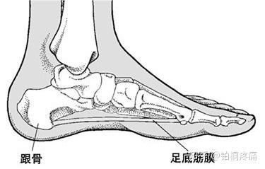 足跟痛你中招了么