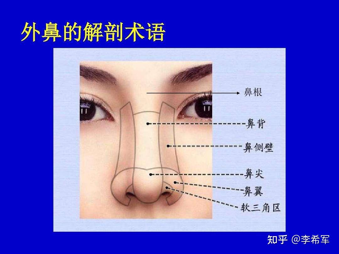 【驼峰鼻】驼峰鼻矫正涉及，鼻骨截除，缩窄，鼻中隔软骨矫正，鼻尖重塑，是比较复杂的鼻整形手术。 - 知乎