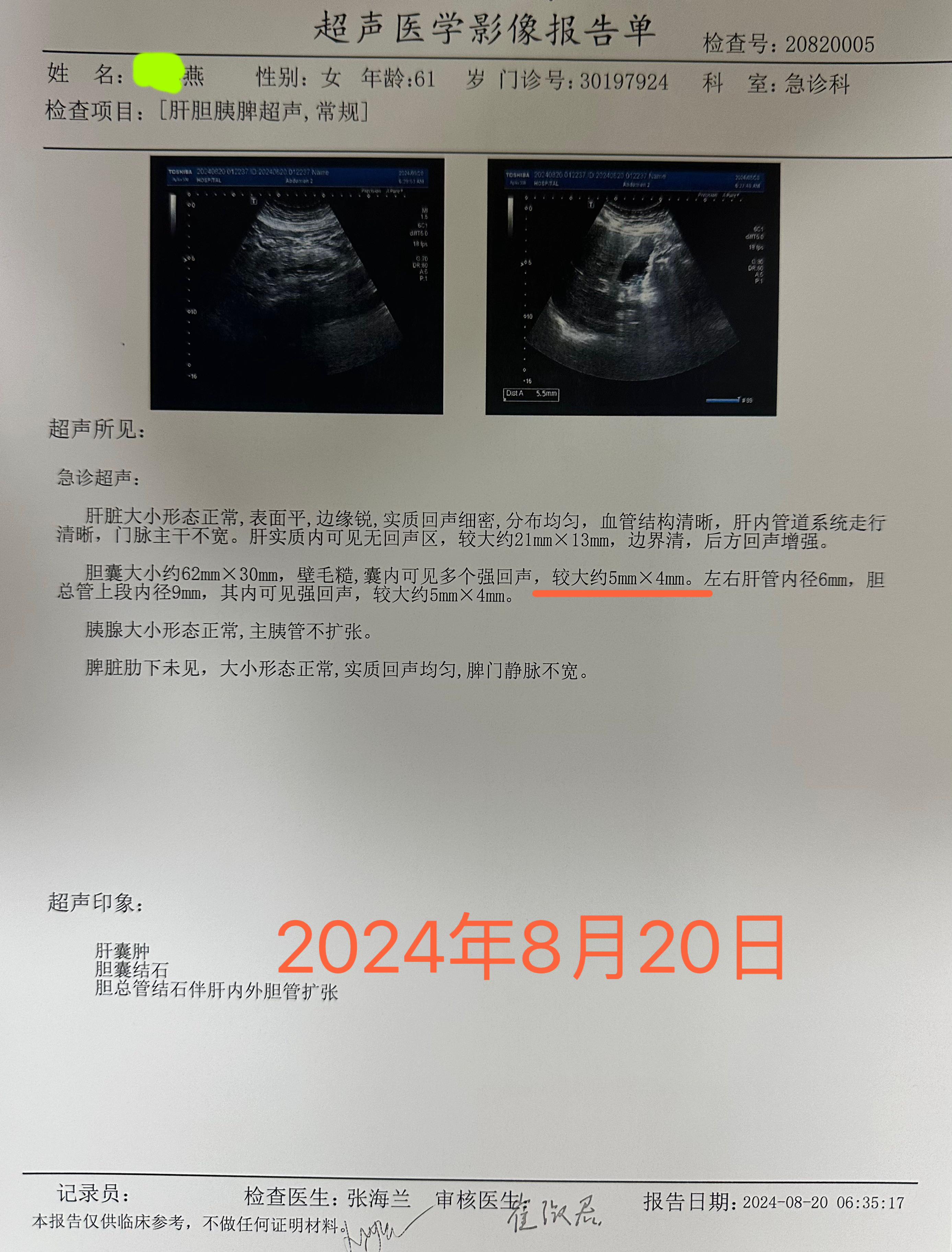 中医治疗胆结石