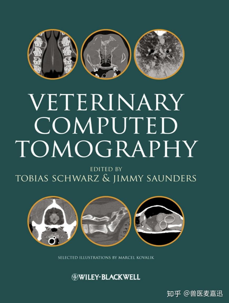 high pitch blurring螺旋ct是一种体积扫描程序,患者