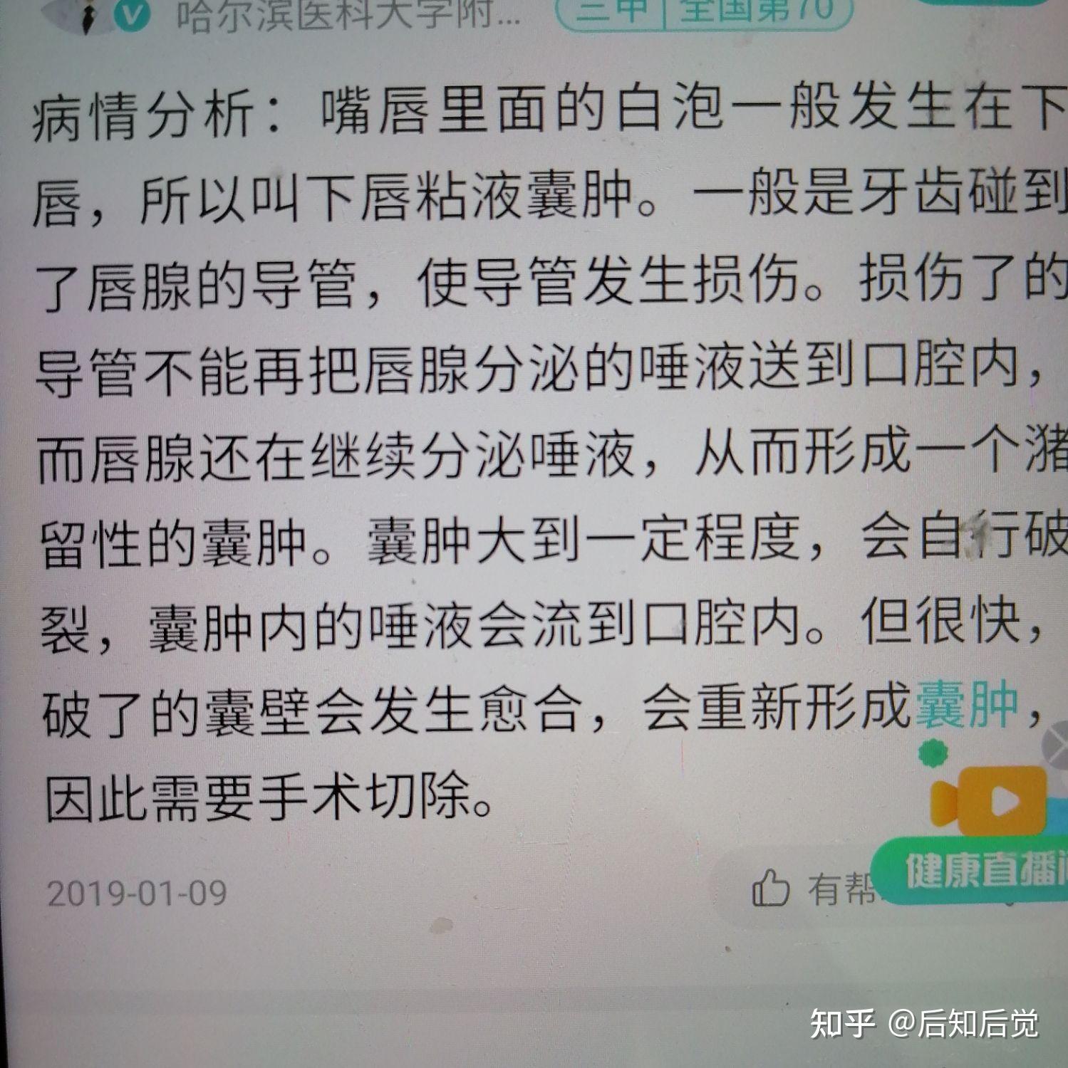 烤火斑能自愈吗图片