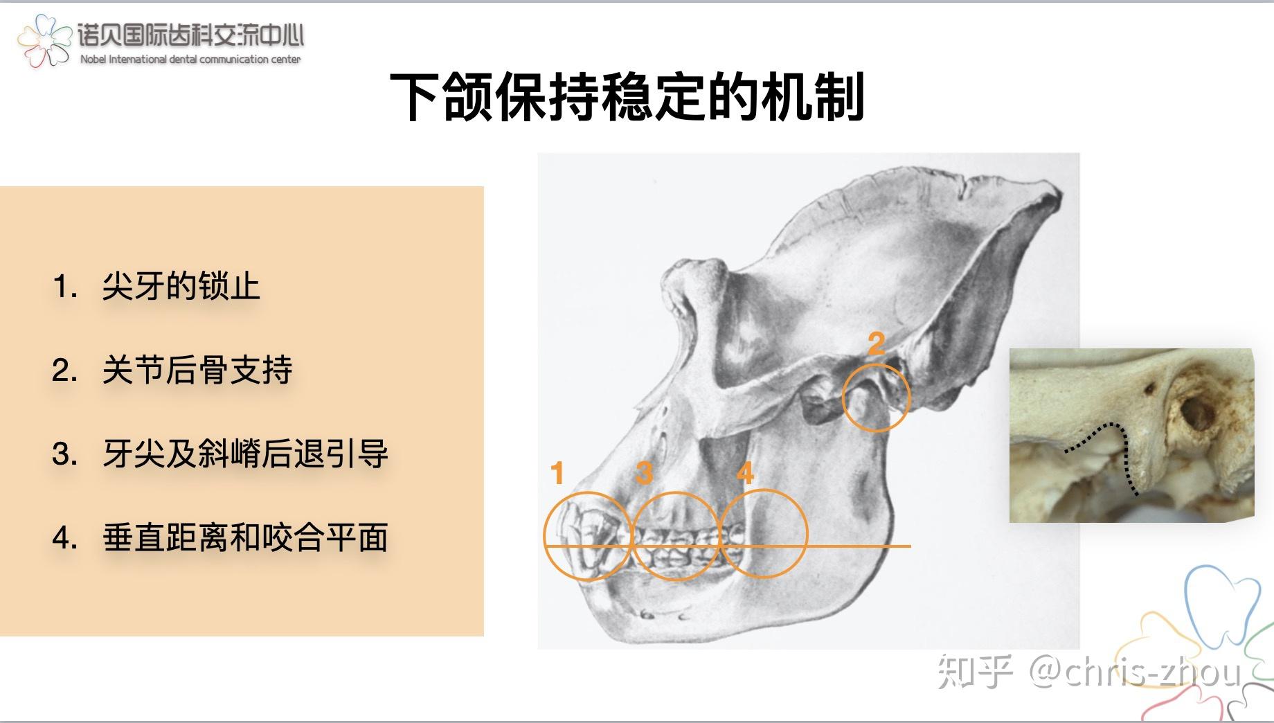 下颌骨(内侧面观)-外科解剖学-医学