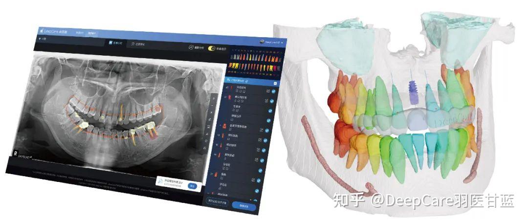 第四版 口腔外科学 口腔外科学 第4版