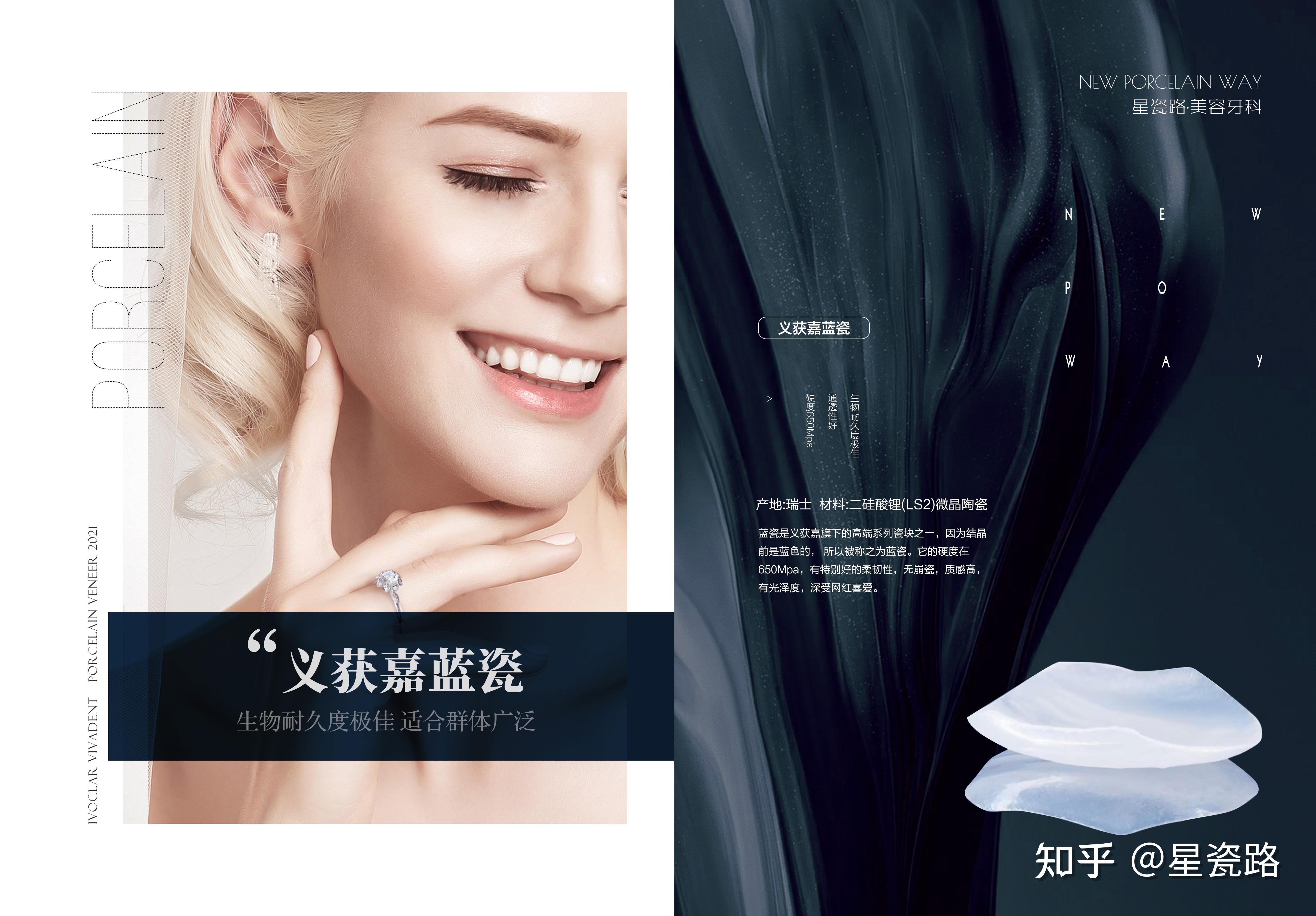 星瓷路为你带来最新科普全瓷贴面修复是什么