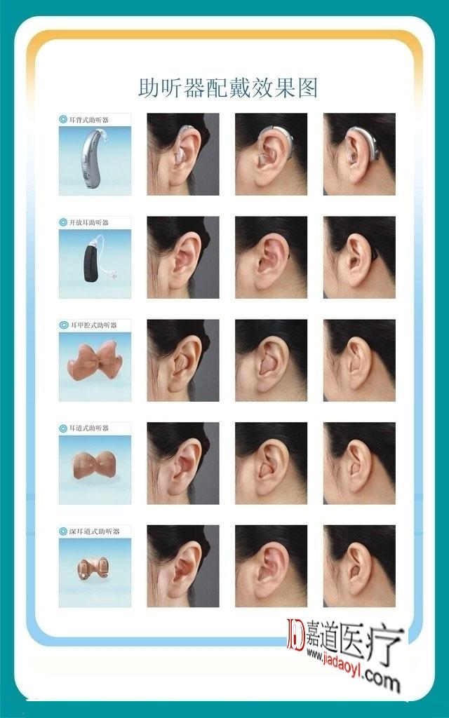 部分患者初戴助听器会不习惯,美国ab人工耳蜗